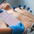 Eletrocardiograma