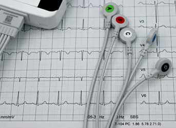 Eletrocardiograma em Curitiba - Exames Cardiológicos e ECG